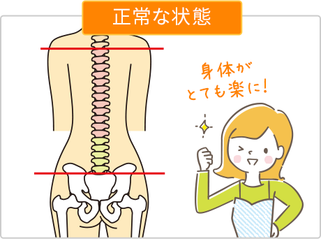 背骨の正常な状態のイラスト図